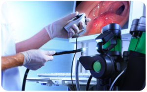 endoscopy